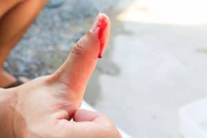 finger blood