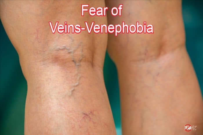 fear-of-veins-venephobia