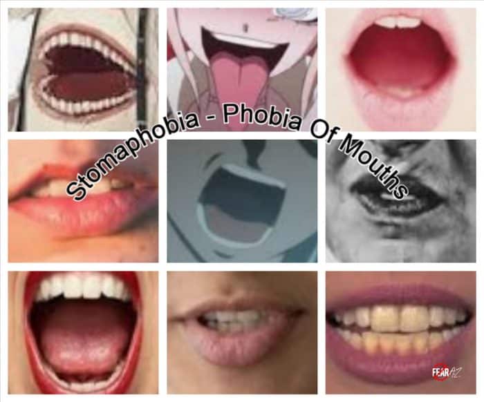 Stomaphobia Fear of Mouths